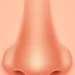 Rhinoplasty